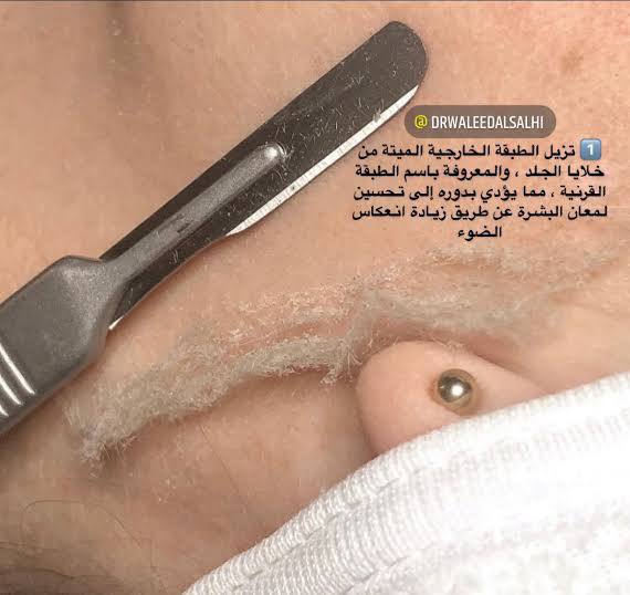 ٤٥ج